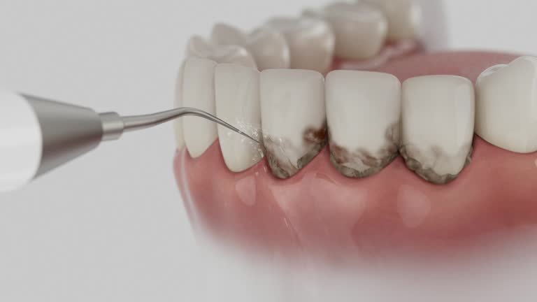 Trusted Wisdom Tooth Removal service in Manito, IL - Dentist Open Now